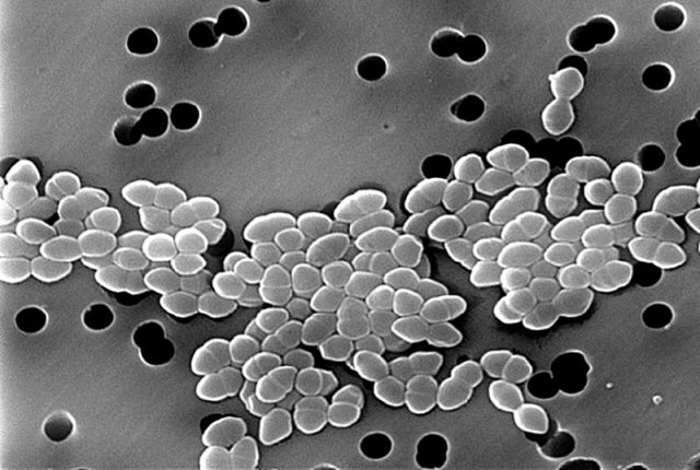 Scanning electron micrograph of enterococci. 