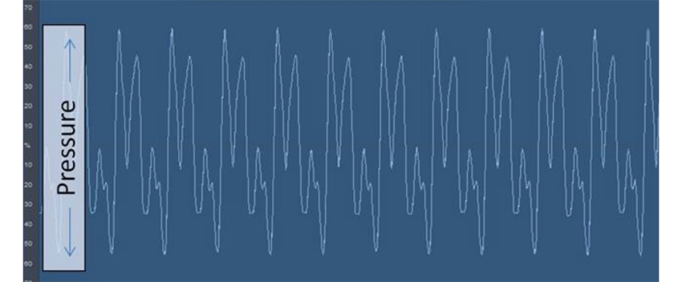 An image of sound waves on a blue background; the Y-axis is labeled Pressure