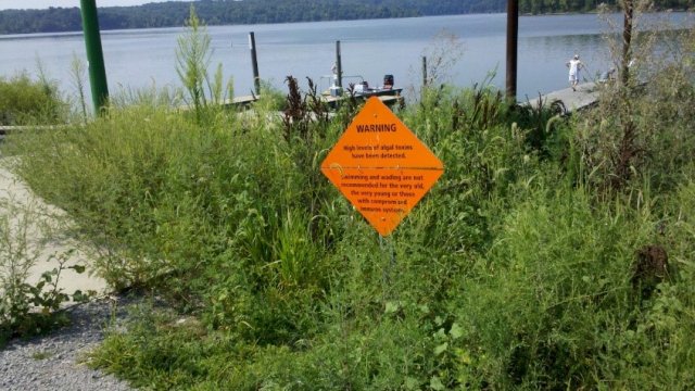 A sign that warns visitors that high levels of cyanobacterial toxins have been detected in the East Fork Reservoir (also known as Harsha Lake), which is a study reservoir located to the east of Cincinnati, OH.